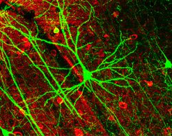 GFP Neuron