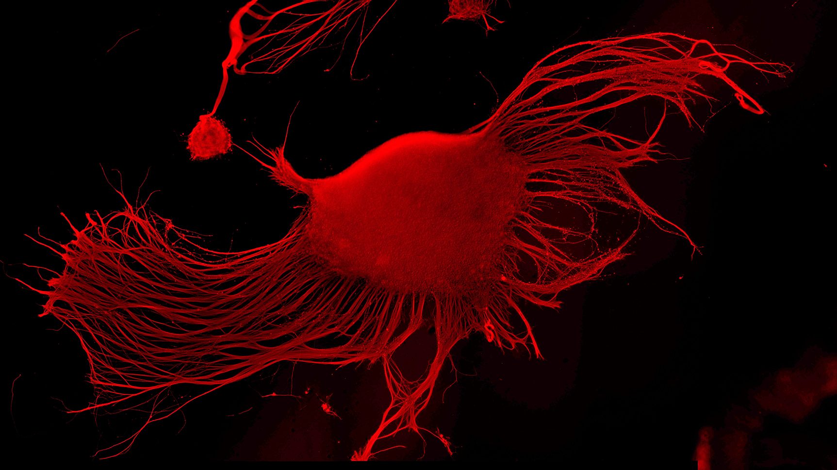 Neural network