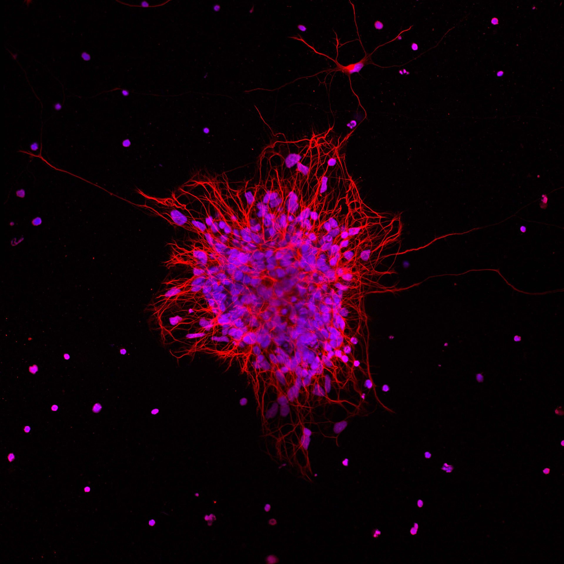 Organoid