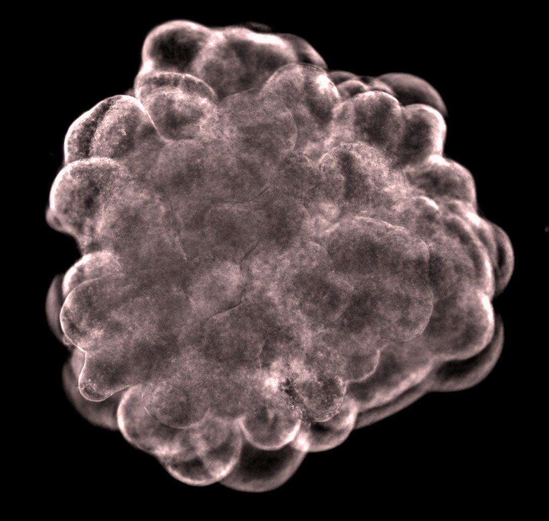 Organoid