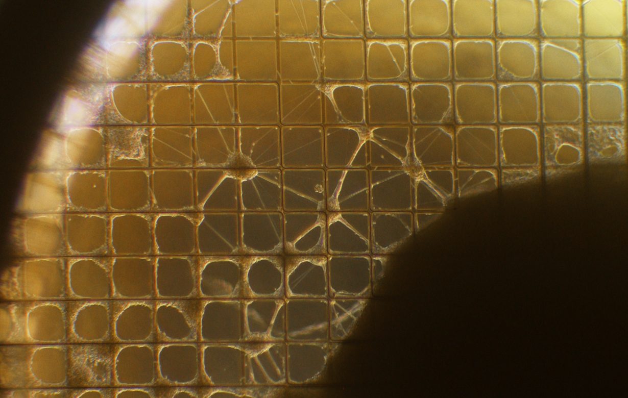 Organoid