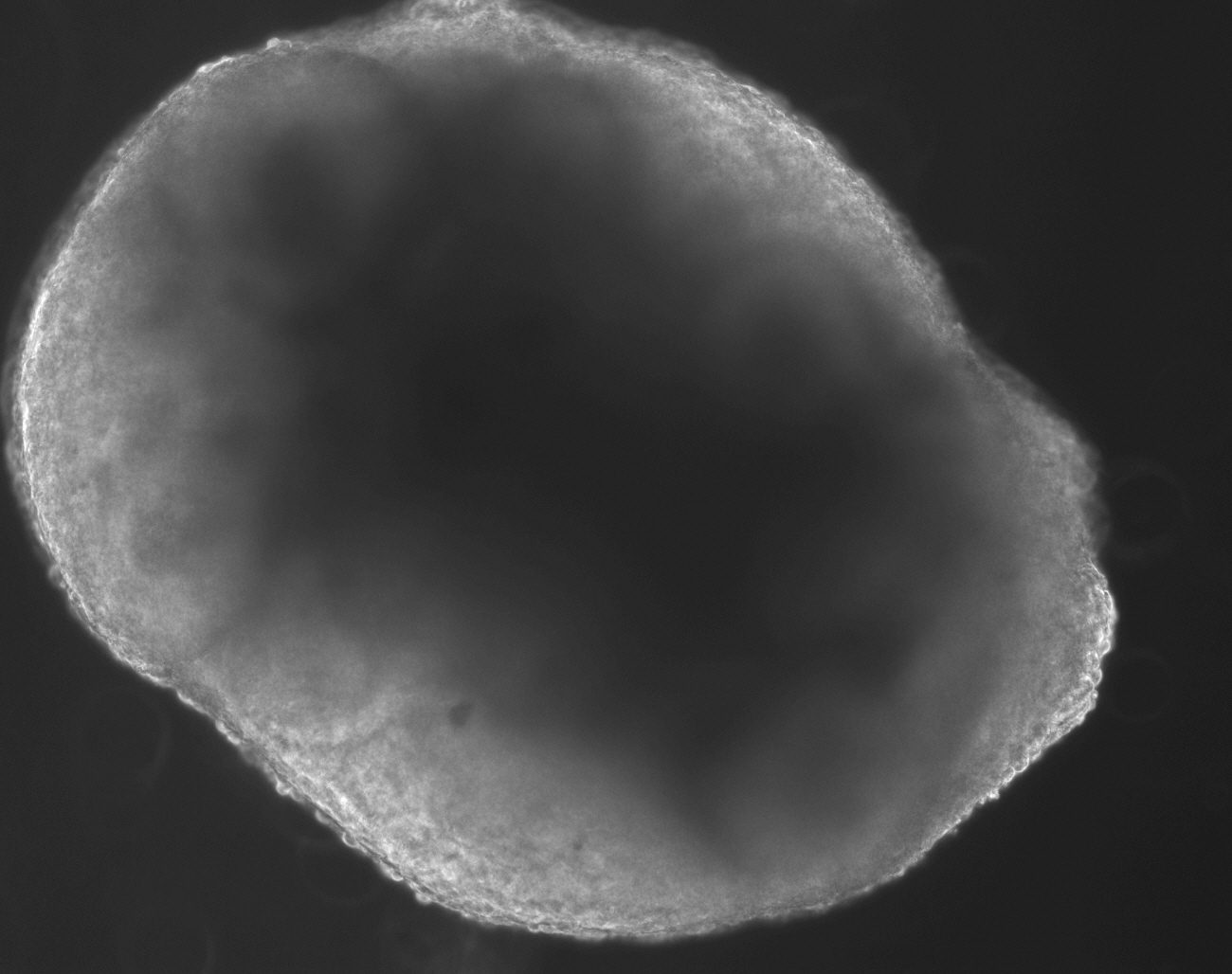 Organoid